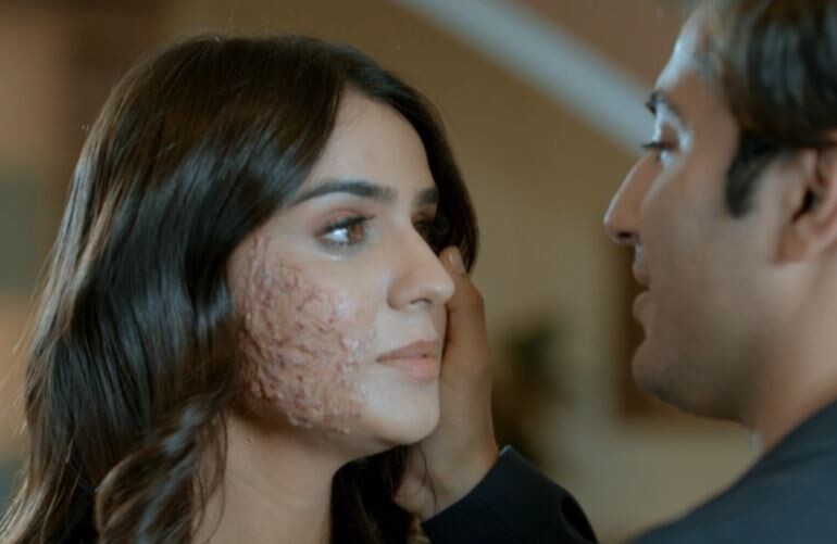 Sidhika Sharma plays an acid victim in her new music video