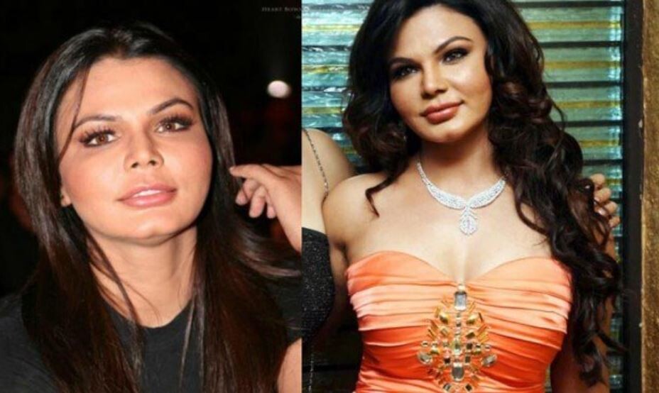 TOP 10 Plastic Surgeries FAIL of Bollywood actors- See Pics  