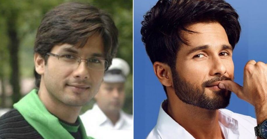 Top 11 Bollywood Actors Male with SHOCKING Plastic Surgery?  